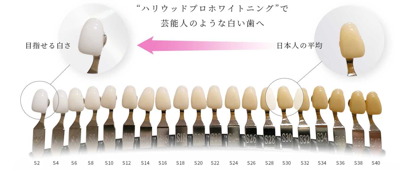 ハリウッドプロホワイトニングで芸能人のような白い歯へ