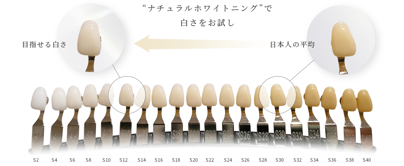 ナチュラルホワイトニングで白さをお試し