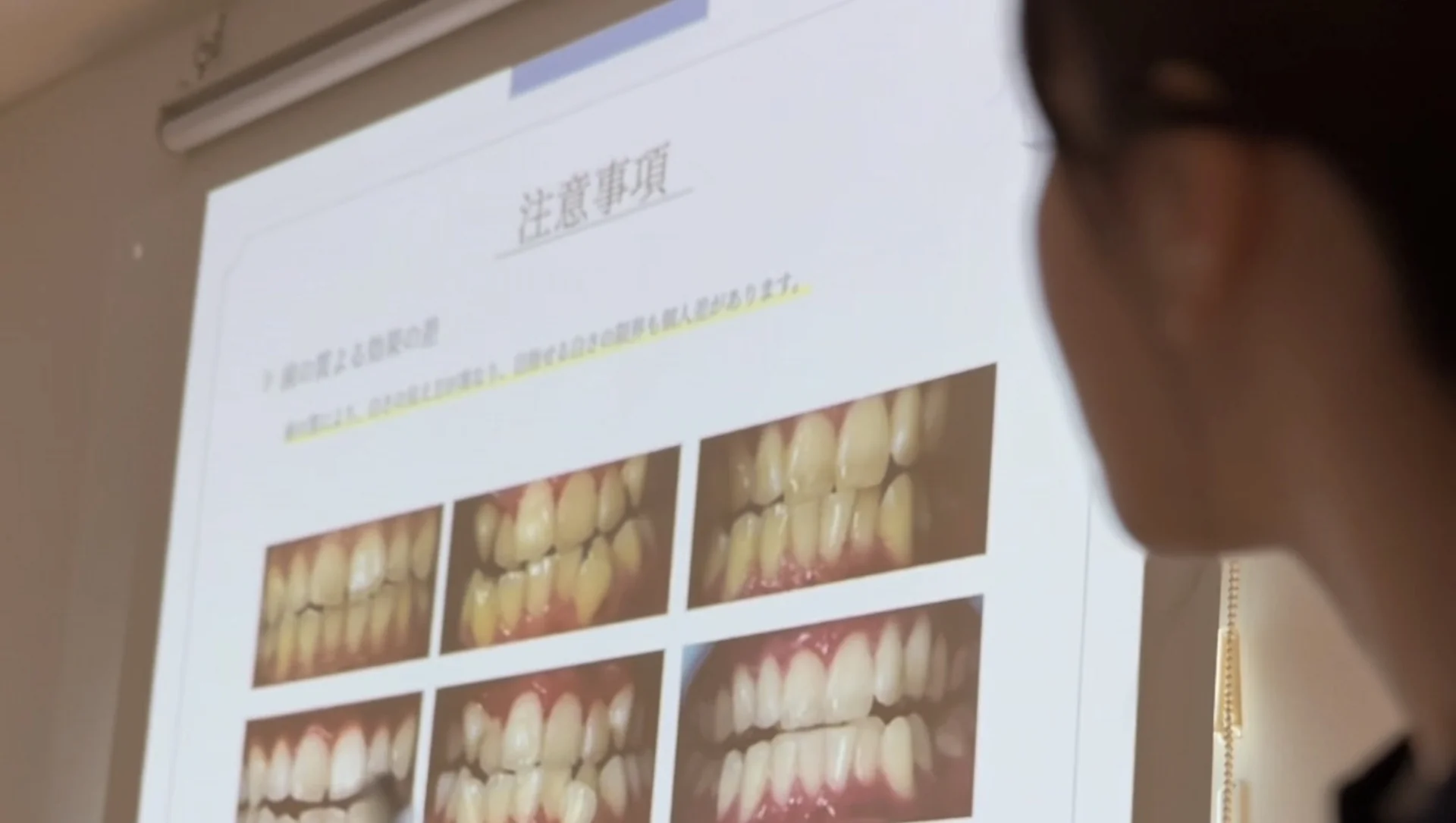 初回30分で効果を実感