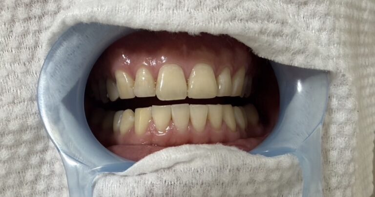 Before