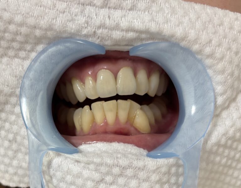 Before