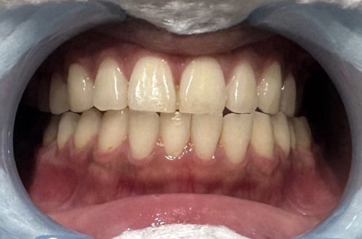 Before